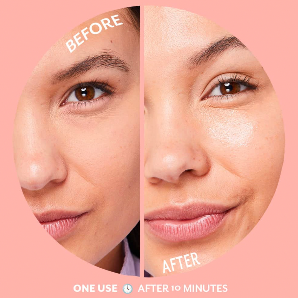 Patchology Serve Chilled Bubbly Brightening Mask
